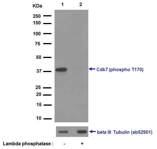 Western blot - Anti-Cdk7 (phospho T170) antibody [EPR6650(2)] (AB155976)