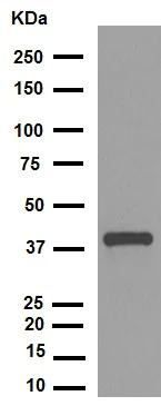 Western blot - Anti-Cdk7 (phospho T170) antibody [EPR6650(2)] (AB155976)