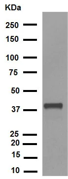Western blot - Anti-Cdk7 (phospho T170) antibody [EPR6650(2)] (AB155976)