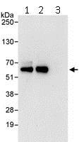Immunoprecipitation - Anti-Cdk8 antibody (AB115155)