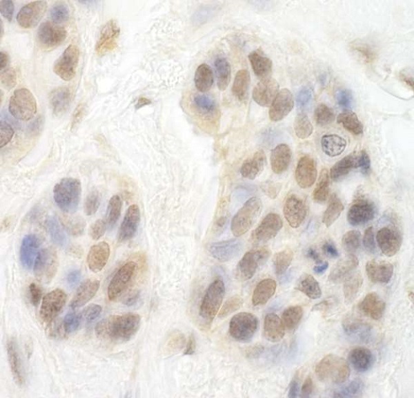 Immunohistochemistry (Formalin/PFA-fixed paraffin-embedded sections) - Anti-Cdk8 antibody (AB224828), expandable thumbnail