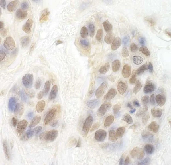 Immunohistochemistry (Formalin/PFA-fixed paraffin-embedded sections) - Anti-Cdk8 antibody (AB224828)