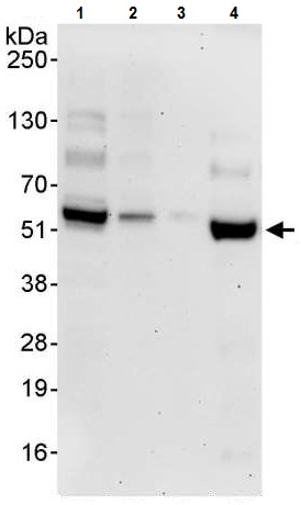 Western blot - Anti-Cdk8 antibody (AB224828), expandable thumbnail