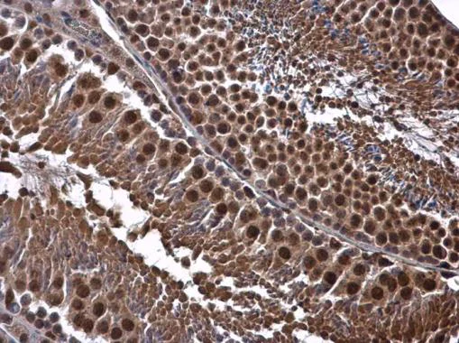 Immunohistochemistry (Formalin/PFA-fixed paraffin-embedded sections) - Anti-Cdk8 antibody (AB272879)