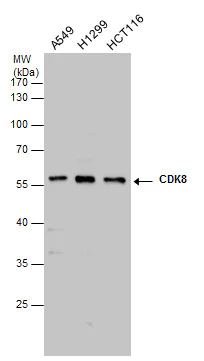 Western blot - Anti-Cdk8 antibody (AB272879)