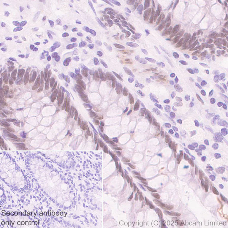 Immunohistochemistry (Formalin/PFA-fixed paraffin-embedded sections) - Anti-Cdk8 antibody [EPR26566-270] (AB325133)