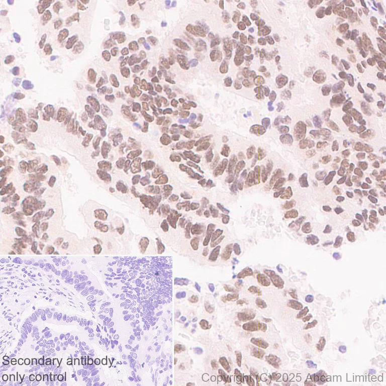 Immunohistochemistry (Formalin/PFA-fixed paraffin-embedded sections) - Anti-Cdk8 antibody [EPR26566-270] - BSA and Azide free (AB325146)