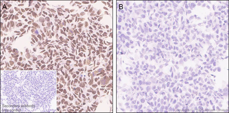 Immunohistochemistry (Formalin/PFA-fixed paraffin-embedded sections) - Anti-Cdk8 antibody [EPR26566-270] - BSA and Azide free (AB325146)