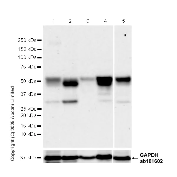 Western blot - Anti-Cdk8 antibody [EPR26566-270] - BSA and Azide free (AB325146)