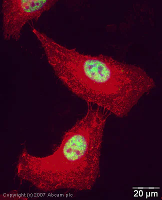 Immunocytochemistry/ Immunofluorescence - Anti-Cdk9 antibody (AB38840)