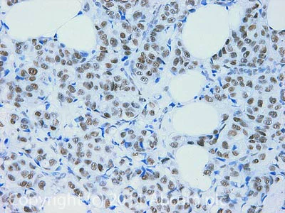 Immunohistochemistry (Formalin/PFA-fixed paraffin-embedded sections) - Anti-Cdk9 antibody (AB38840)