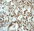 Immunohistochemistry (Formalin/PFA-fixed paraffin-embedded sections) - Anti-Cdk9 antibody [EP3118] (AB75848)