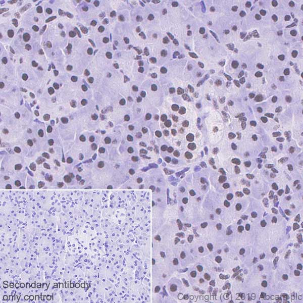 Immunohistochemistry (Formalin/PFA-fixed paraffin-embedded sections) - Anti-Cdk9 antibody [EPR22956-37] - ChIP Grade - BSA and Azide free (ab259268), expandable thumbnail