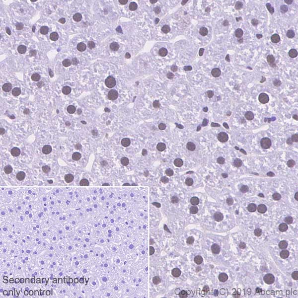 Immunohistochemistry (Formalin/PFA-fixed paraffin-embedded sections) - Anti-Cdk9 antibody [EPR22956-37] - ChIP Grade - BSA and Azide free (ab259268), expandable thumbnail