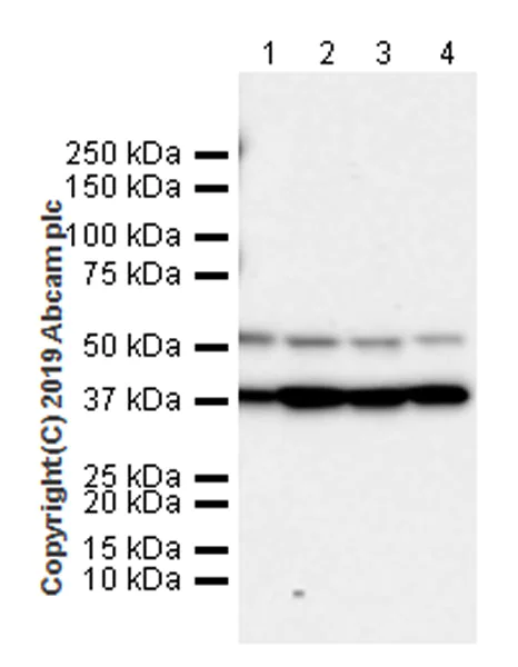 Western blot - Anti-Cdk9 antibody [EPR22956-60] (AB261724)