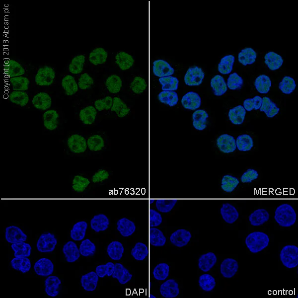 Immunocytochemistry/ Immunofluorescence - Anti-Cdk9 antibody [EPR3119Y] (AB76320)