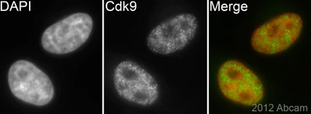 Immunocytochemistry/ Immunofluorescence - Anti-Cdk9 antibody [EPR3119Y] - BSA and Azide free (AB236045)