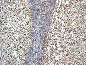 Immunohistochemistry (Formalin/PFA-fixed paraffin-embedded sections) - Anti-Cdk9 antibody [EPR3119Y] - BSA and Azide free (AB236045)