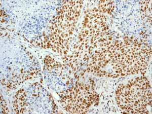 Immunohistochemistry (Formalin/PFA-fixed paraffin-embedded sections) - Anti-Cdk9 antibody [EPR3119Y] - BSA and Azide free (AB236045)