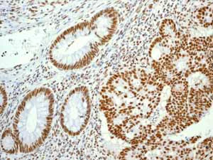 Immunohistochemistry (Formalin/PFA-fixed paraffin-embedded sections) - Anti-Cdk9 antibody [EPR3119Y] - BSA and Azide free (AB236045)