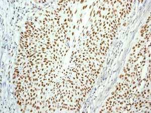 Immunohistochemistry (Formalin/PFA-fixed paraffin-embedded sections) - Anti-Cdk9 antibody [EPR3119Y] - BSA and Azide free (AB236045)