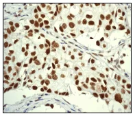 Immunohistochemistry (Formalin/PFA-fixed paraffin-embedded sections) - Anti-Cdk9 antibody [EPR3119Y] - BSA and Azide free (AB236045)