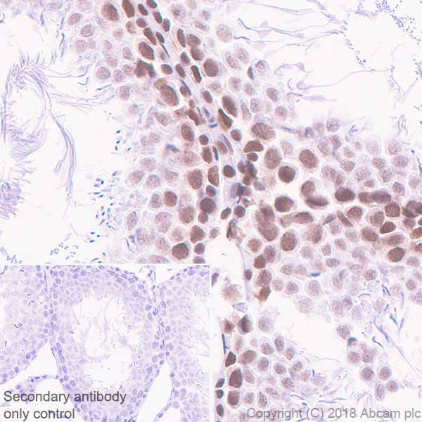Immunohistochemistry (Formalin/PFA-fixed paraffin-embedded sections) - Anti-Cdk9 antibody [EPR3119Y] - BSA and Azide free (AB236045)
