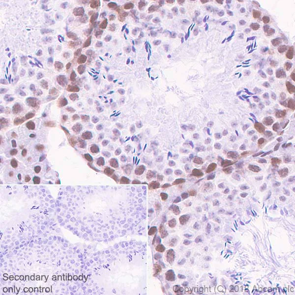 Immunohistochemistry (Formalin/PFA-fixed paraffin-embedded sections) - Anti-Cdk9 antibody [EPR3119Y] - BSA and Azide free (AB236045)