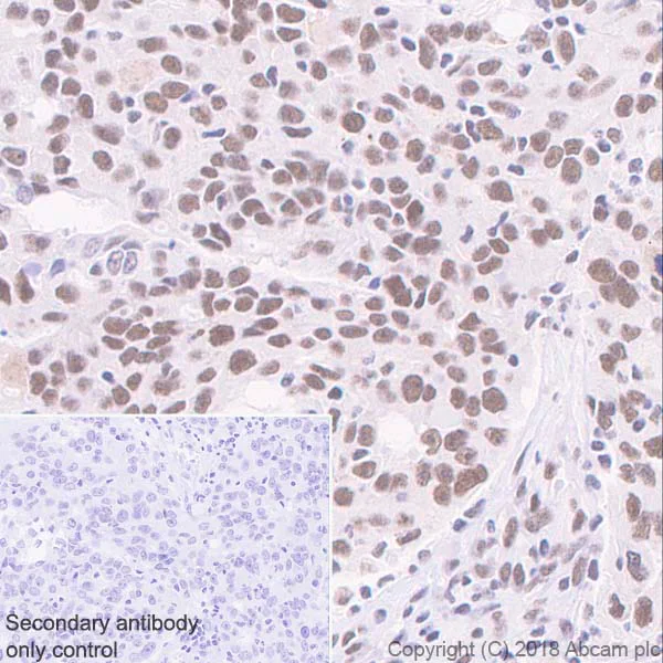 Immunohistochemistry (Formalin/PFA-fixed paraffin-embedded sections) - Anti-Cdk9 antibody [EPR3119Y] - BSA and Azide free (AB236045)