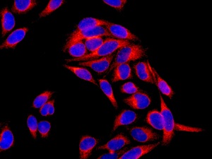Immunocytochemistry/ Immunofluorescence - Anti-CDKAL1 antibody [EPR11621-26] (AB169531)