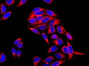 Immunocytochemistry/ Immunofluorescence - Anti-CDKAL1 antibody [EPR11621-26] (AB169531)