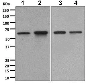 Western blot - Anti-CDKAL1 antibody [EPR11621-26] (AB169531)