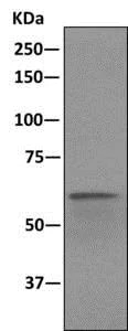 Western blot - Anti-CDKAL1 antibody [EPR11621-26] (AB169531)