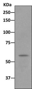 Immunoprecipitation - Anti-CDKAL1 antibody [EPR11621] (AB168390)