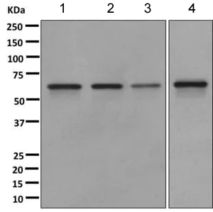 Western blot - Anti-CDKAL1 antibody [EPR11621] (AB168390)