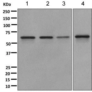 Western blot - Anti-CDKAL1 antibody [EPR11621] - BSA and Azide free (AB249477)