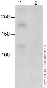 Western blot - Anti-CDKL5 antibody (AB22453)
