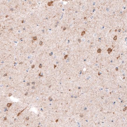 Immunohistochemistry (Formalin/PFA-fixed paraffin-embedded sections) - Anti-CDKL5 antibody [CL4881] (AB242373), expandable thumbnail
