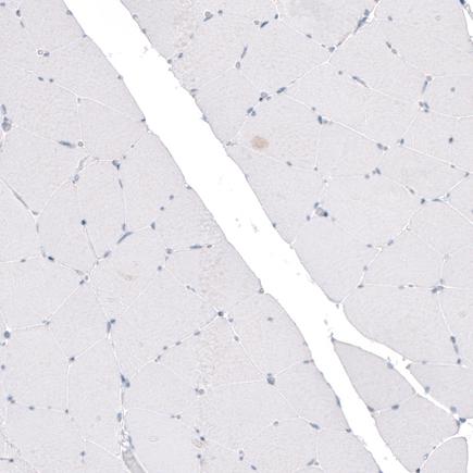 Immunohistochemistry (Formalin/PFA-fixed paraffin-embedded sections) - Anti-CDKL5 antibody [CL4881] (AB242373), expandable thumbnail