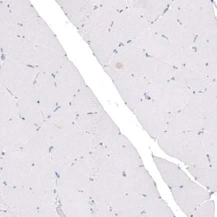 Immunohistochemistry (Formalin/PFA-fixed paraffin-embedded sections) - Anti-CDKL5 antibody [CL4881] (AB242373)