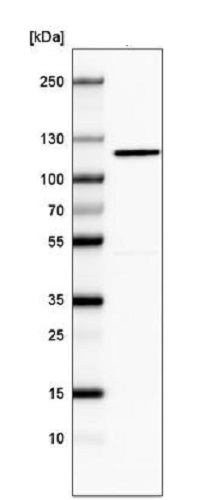 Western blot - Anti-CDKL5 antibody [CL4881] (AB242373), expandable thumbnail