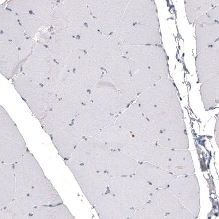 Immunohistochemistry (Formalin/PFA-fixed paraffin-embedded sections) - Anti-CDKL5 antibody [CL4888] (AB242358)