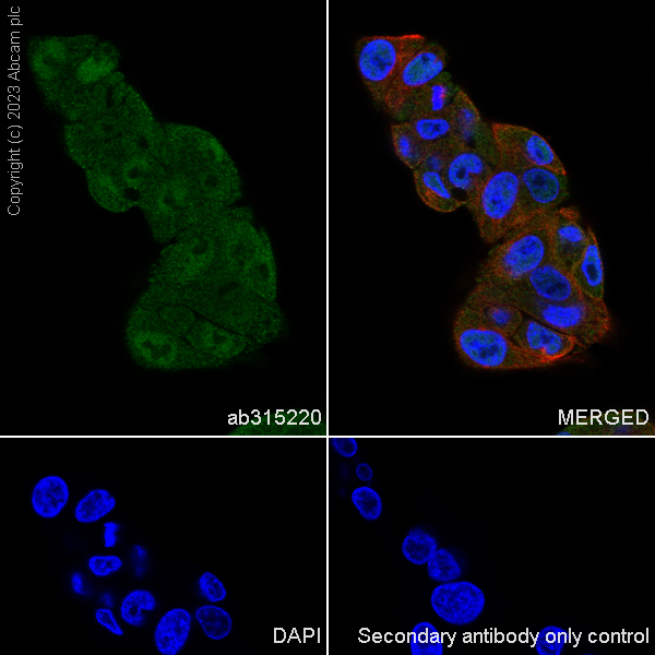 Immunocytochemistry/ Immunofluorescence - Anti-CDKL5 antibody [EPR26906-28] - BSA and Azide free (AB315221), expandable thumbnail