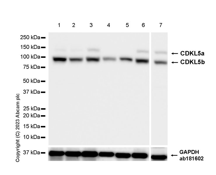 Western blot - Anti-CDKL5 antibody [EPR26906-28] - BSA and Azide free (ab315221), expandable thumbnail