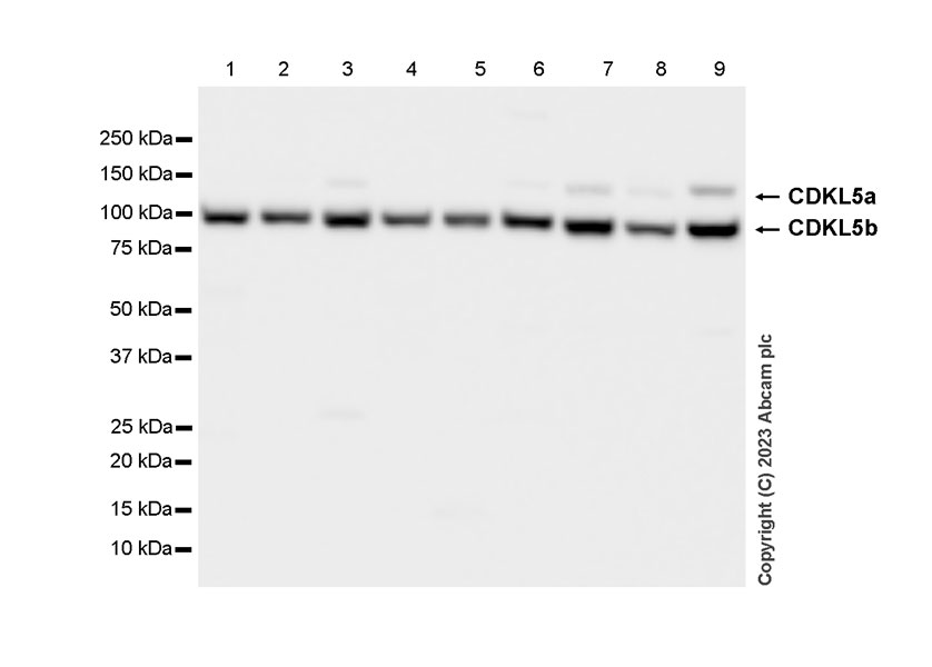 Western blot - Anti-CDKL5 antibody [EPR26906-28] - BSA and Azide free (AB315221), expandable thumbnail