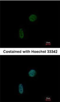 Immunocytochemistry/ Immunofluorescence - Anti-CDKN1A interacting zinc finger protein 1/CIZ1 antibody (AB102013)