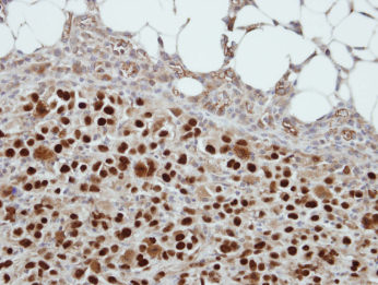 Immunohistochemistry (Formalin/PFA-fixed paraffin-embedded sections) - Anti-CDKN1A interacting zinc finger protein 1/CIZ1 antibody (AB102013)