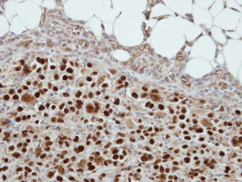 Immunohistochemistry (Formalin/PFA-fixed paraffin-embedded sections) - Anti-CDKN1A interacting zinc finger protein 1/CIZ1 antibody (AB102013)