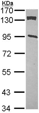 Western blot - Anti-CDKN1A interacting zinc finger protein 1/CIZ1 antibody (AB102013)
