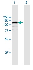 Western blot - Anti-CDKN1A interacting zinc finger protein 1/CIZ1 antibody (AB172442)